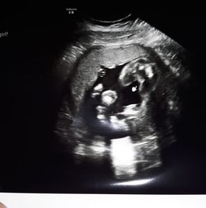 Meet your Posher, Dienda